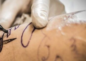 Tukang Tato di Bandung ‘Ngetok’ Harga hingga Lakukan Penganiayaan, Korban Ambil Jalur Hukum