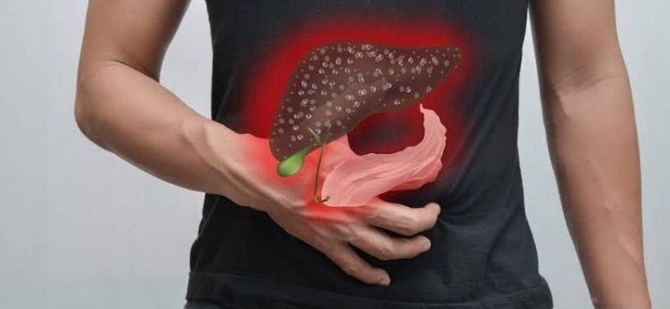 Kemenkes Terbitkan Edaran Kewaspadaan Penemuan Kasus Hepatitis Akut
