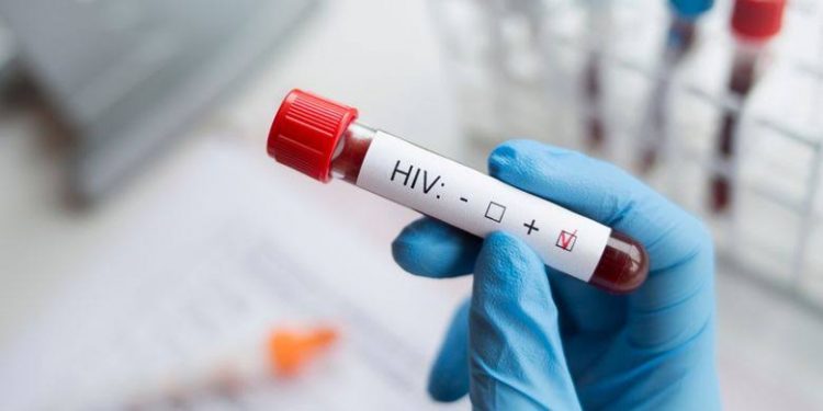 Yana Mulyana Soroti Kasus HIV/AIDS di Kota Bandung Mencapai 5.000 Lebih